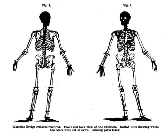 The skeleton from the 1857 Waterloo Bridge Mystery